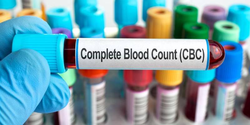 Complete Blood Count Trivia Quiz