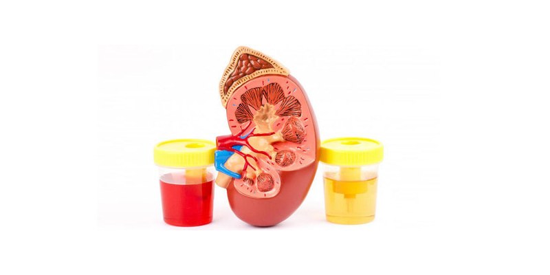 Quiz: How Much You Know About Hematuria?