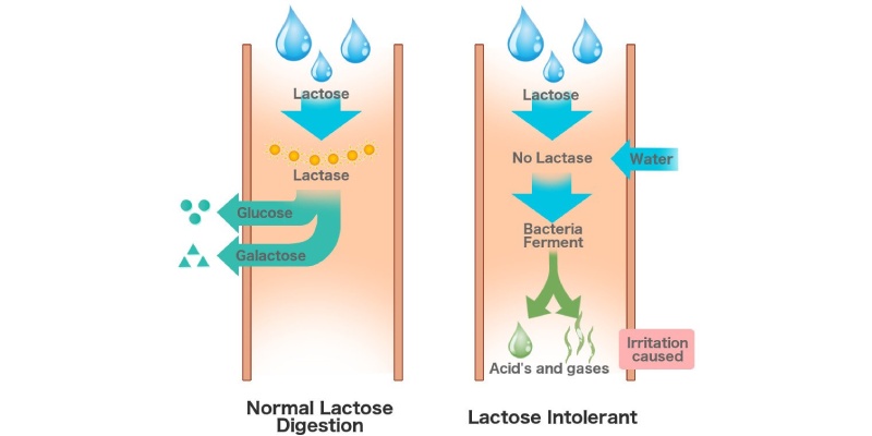 How To Tell If You Are Lactose Intolerant Quiz BestFunQuiz