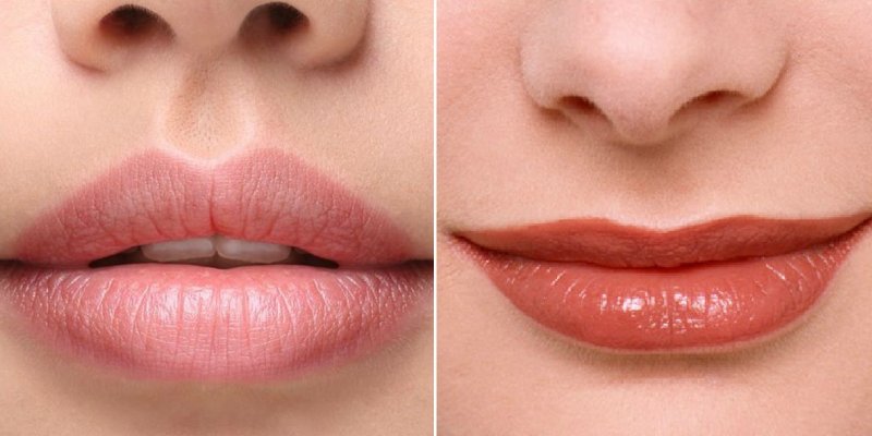 Quiz What Is My Lip Shape? BestFunQuiz